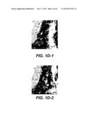 UPREGULATION OF RACK-1 IN MELANOMA AND ITS USE AS A MARKER diagram and image