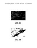 UPREGULATION OF RACK-1 IN MELANOMA AND ITS USE AS A MARKER diagram and image