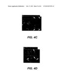 UPREGULATION OF RACK-1 IN MELANOMA AND ITS USE AS A MARKER diagram and image