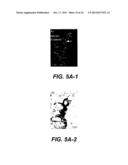 UPREGULATION OF RACK-1 IN MELANOMA AND ITS USE AS A MARKER diagram and image