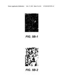 UPREGULATION OF RACK-1 IN MELANOMA AND ITS USE AS A MARKER diagram and image