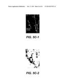 UPREGULATION OF RACK-1 IN MELANOMA AND ITS USE AS A MARKER diagram and image