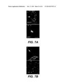 UPREGULATION OF RACK-1 IN MELANOMA AND ITS USE AS A MARKER diagram and image