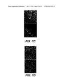 UPREGULATION OF RACK-1 IN MELANOMA AND ITS USE AS A MARKER diagram and image