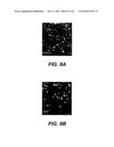 UPREGULATION OF RACK-1 IN MELANOMA AND ITS USE AS A MARKER diagram and image