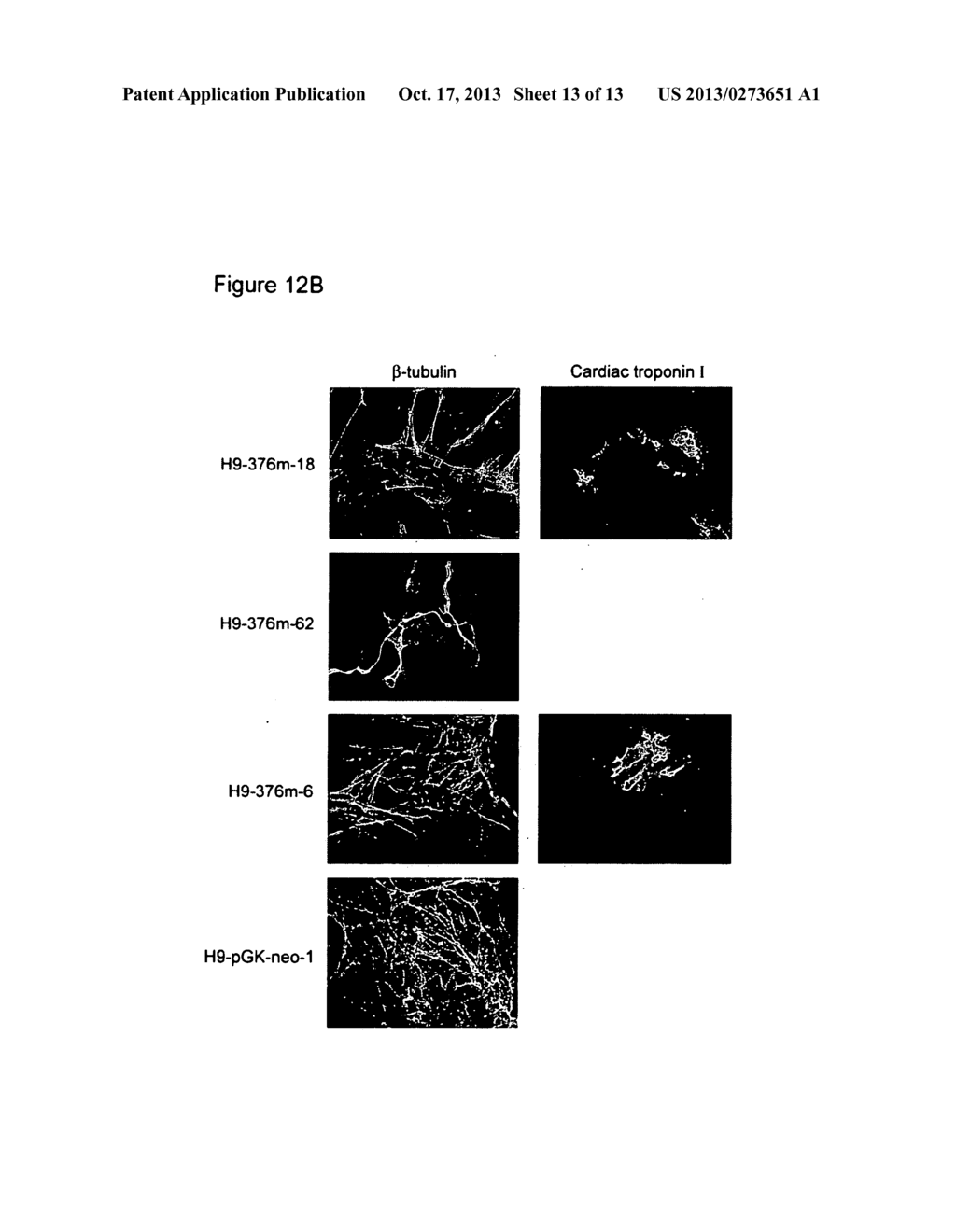 DIFFERENTIATED CELLS SUITABLE FOR HUMAN THERAPY - diagram, schematic, and image 14