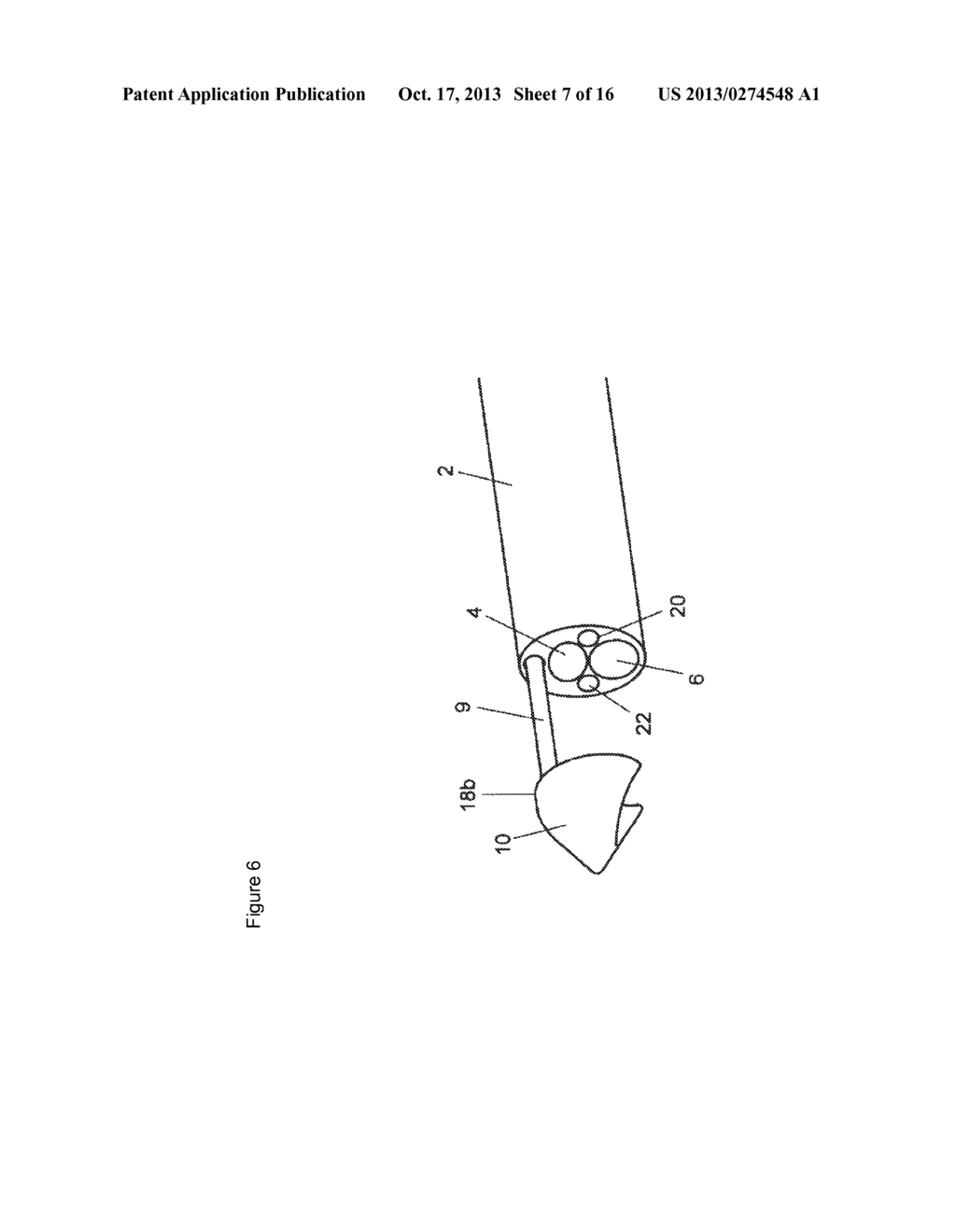 INVASIVE INSTRUMENT FOR TREATING VESSELS - diagram, schematic, and image 08