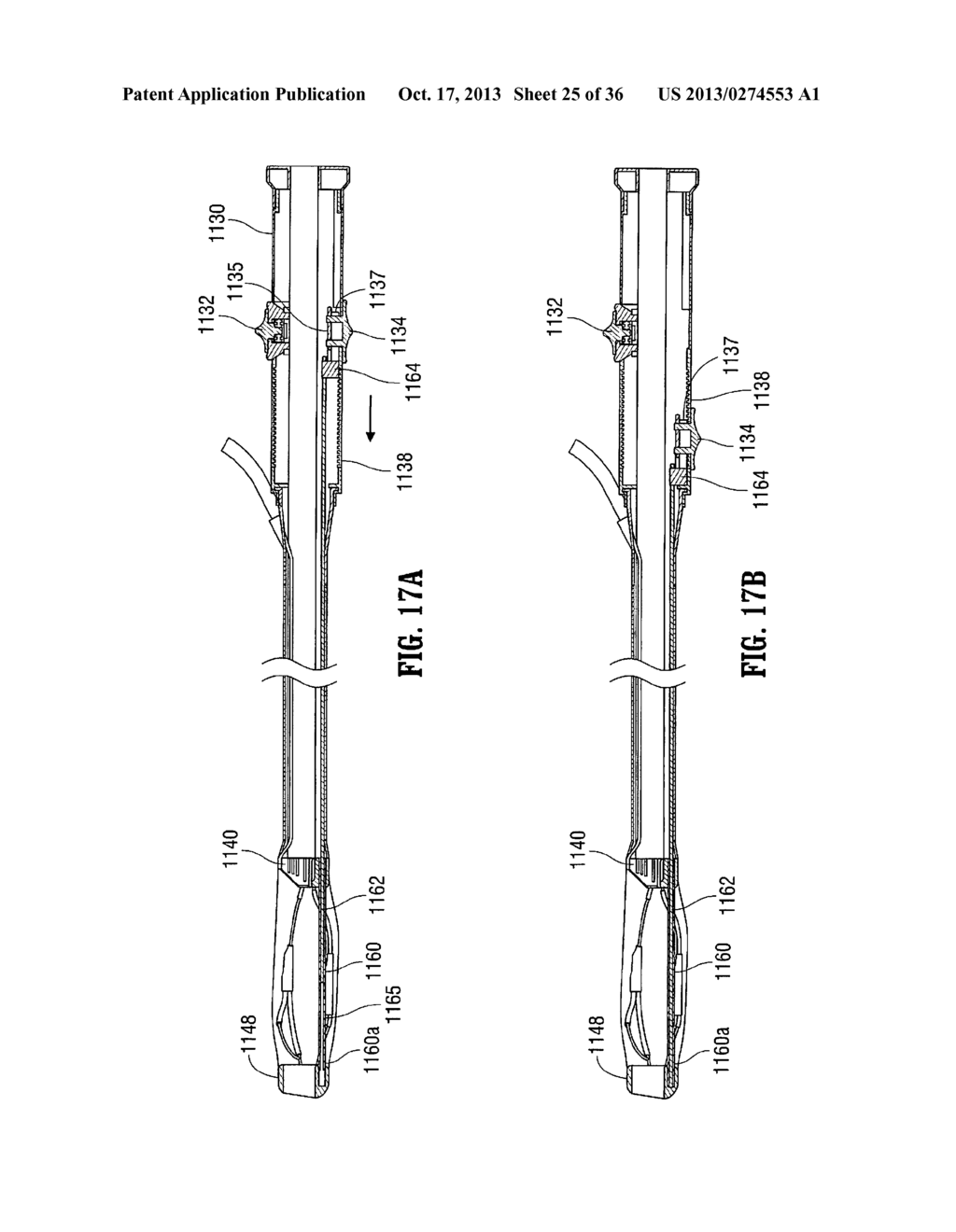 MULTI-LUMEN-CATHETER RETRACTOR SYSTEM FOR A MINIMALLY-INVASIVE, OPERATIVE     GASTROINTESTINAL TREATMENT - diagram, schematic, and image 26