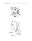 AIRWAY MANAGEMENT diagram and image