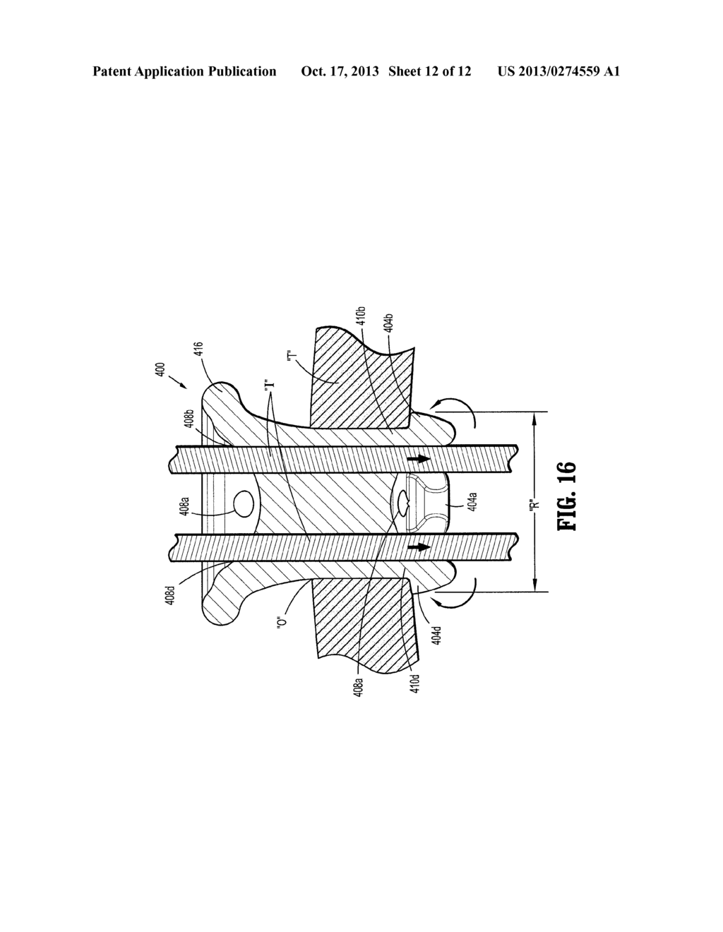 Foam Introduction System Including Modified Port Geometry - diagram, schematic, and image 13