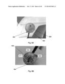 CARDIAC CATHETER EMPLOYING CONFORMAL ELECTRONICS FOR MAPPING diagram and image