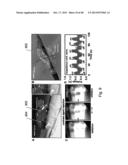 CARDIAC CATHETER EMPLOYING CONFORMAL ELECTRONICS FOR MAPPING diagram and image