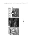 CARDIAC CATHETER EMPLOYING CONFORMAL ELECTRONICS FOR MAPPING diagram and image
