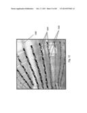 CARDIAC CATHETER EMPLOYING CONFORMAL ELECTRONICS FOR MAPPING diagram and image