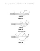 DEVICES AND METHODS FOR DELIVERING AN ENDOCARDIAL DEVICE diagram and image