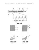 DEVICES AND METHODS FOR DELIVERING AN ENDOCARDIAL DEVICE diagram and image