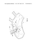 ARTERIAL DEVICE, SYSTEM AND METHOD FOR REMOVING EMBOLIC DEBRIS diagram and image