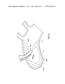 ARTERIAL DEVICE, SYSTEM AND METHOD FOR REMOVING EMBOLIC DEBRIS diagram and image