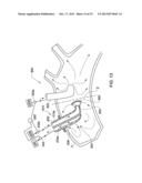 ARTERIAL DEVICE, SYSTEM AND METHOD FOR REMOVING EMBOLIC DEBRIS diagram and image