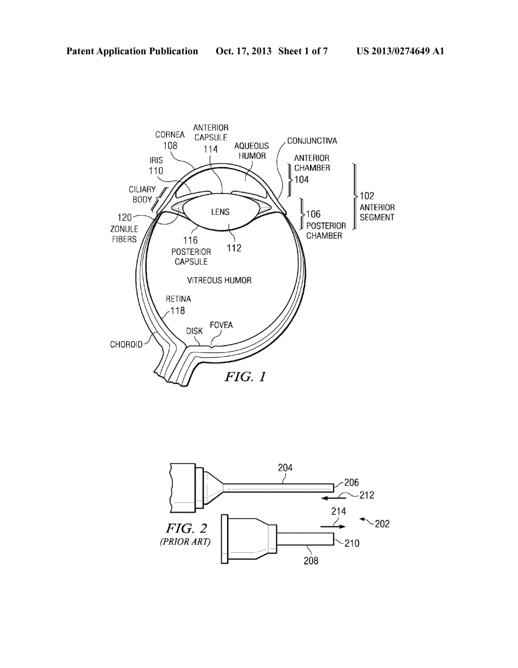 PROBE TIP AND INFUSION SLEEVE FOR USE IN OPHTHALMOLOGICAL SURGERY - diagram, schematic, and image 02