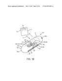 DEVICE, SYSTEM AND METHODS FOR THE ORAL DELIVERY OF THERAPEUTIC COMPOUNDS diagram and image