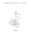 DEVICE, SYSTEM AND METHODS FOR THE ORAL DELIVERY OF THERAPEUTIC COMPOUNDS diagram and image