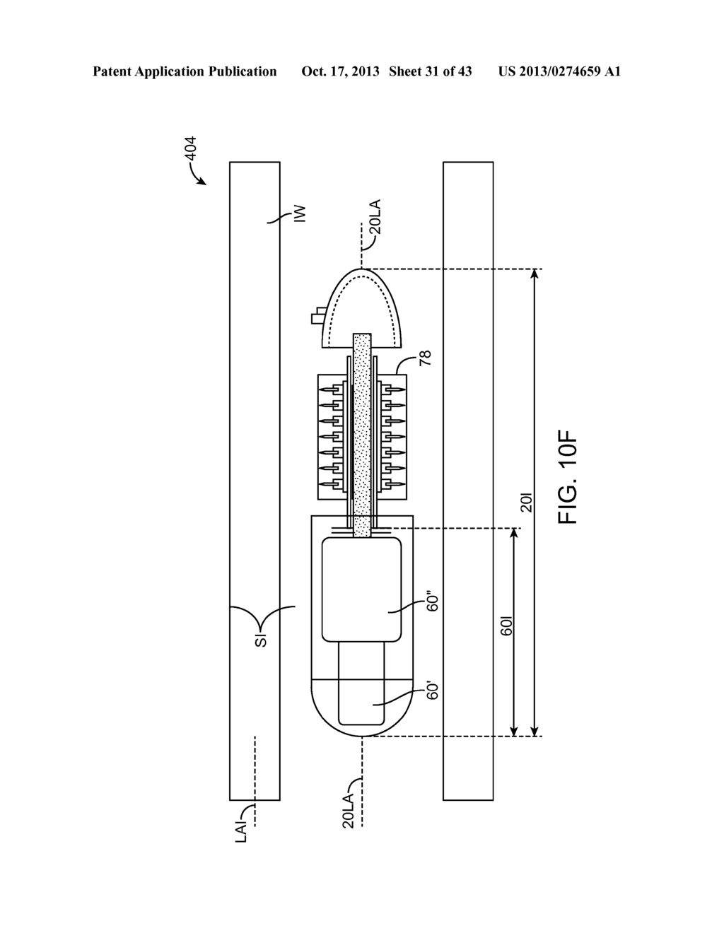 DEVICE, SYSTEM AND METHODS FOR THE ORAL DELIVERY OF THERAPEUTIC COMPOUNDS - diagram, schematic, and image 32