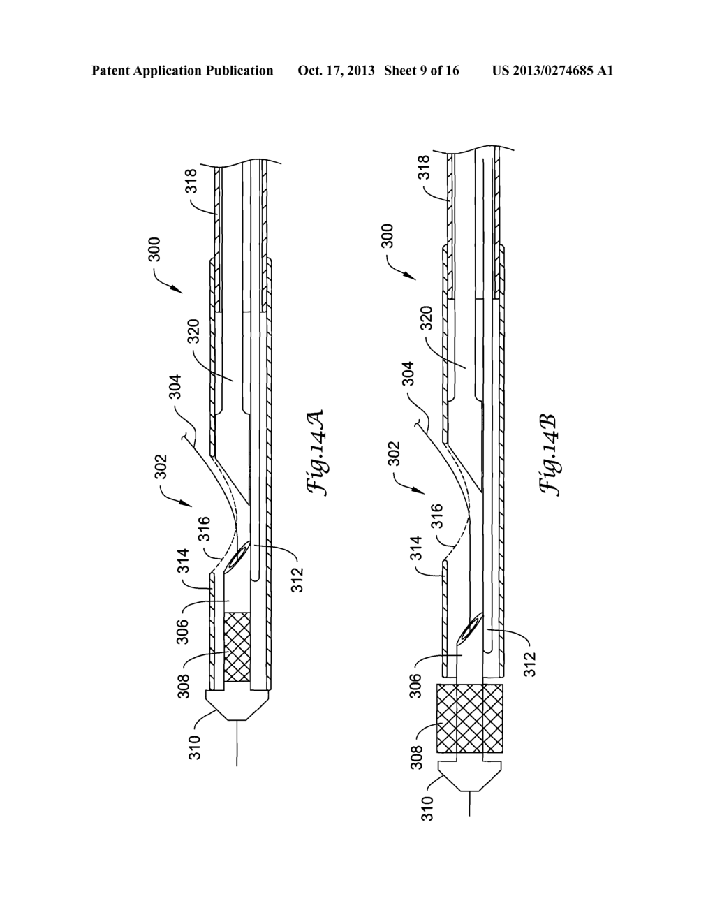 RAPID EXCHANGE ENTERAL STENT DELIVERY SYSTEM - diagram, schematic, and image 10