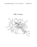 Method and System for Eustachian Tube Dilation diagram and image