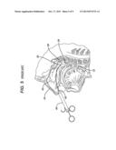 Method and System for Eustachian Tube Dilation diagram and image