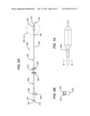 Method and System for Eustachian Tube Dilation diagram and image