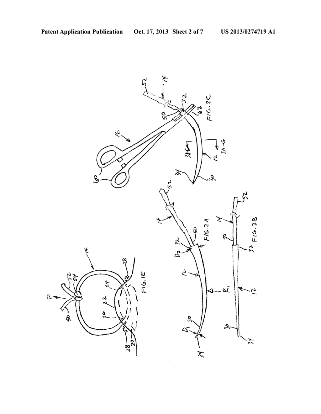 CUTANEOUS ABSCESS DRAINAGE DEVICE AND METHODS - diagram, schematic, and image 03