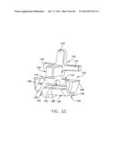 Patient Specific Surgical Guide Locator and Mount diagram and image