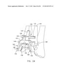 Patient Specific Surgical Guide Locator and Mount diagram and image