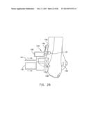 Patient Specific Surgical Guide Locator and Mount diagram and image