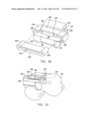 Patient Specific Surgical Guide Locator and Mount diagram and image