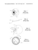 Anterior Capsulotomy Device and Procedure diagram and image