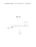 Anterior Capsulotomy Device and Procedure diagram and image