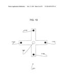 Anterior Capsulotomy Device and Procedure diagram and image