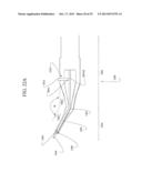 Anterior Capsulotomy Device and Procedure diagram and image