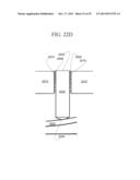 Anterior Capsulotomy Device and Procedure diagram and image