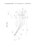 Anterior Capsulotomy Device and Procedure diagram and image