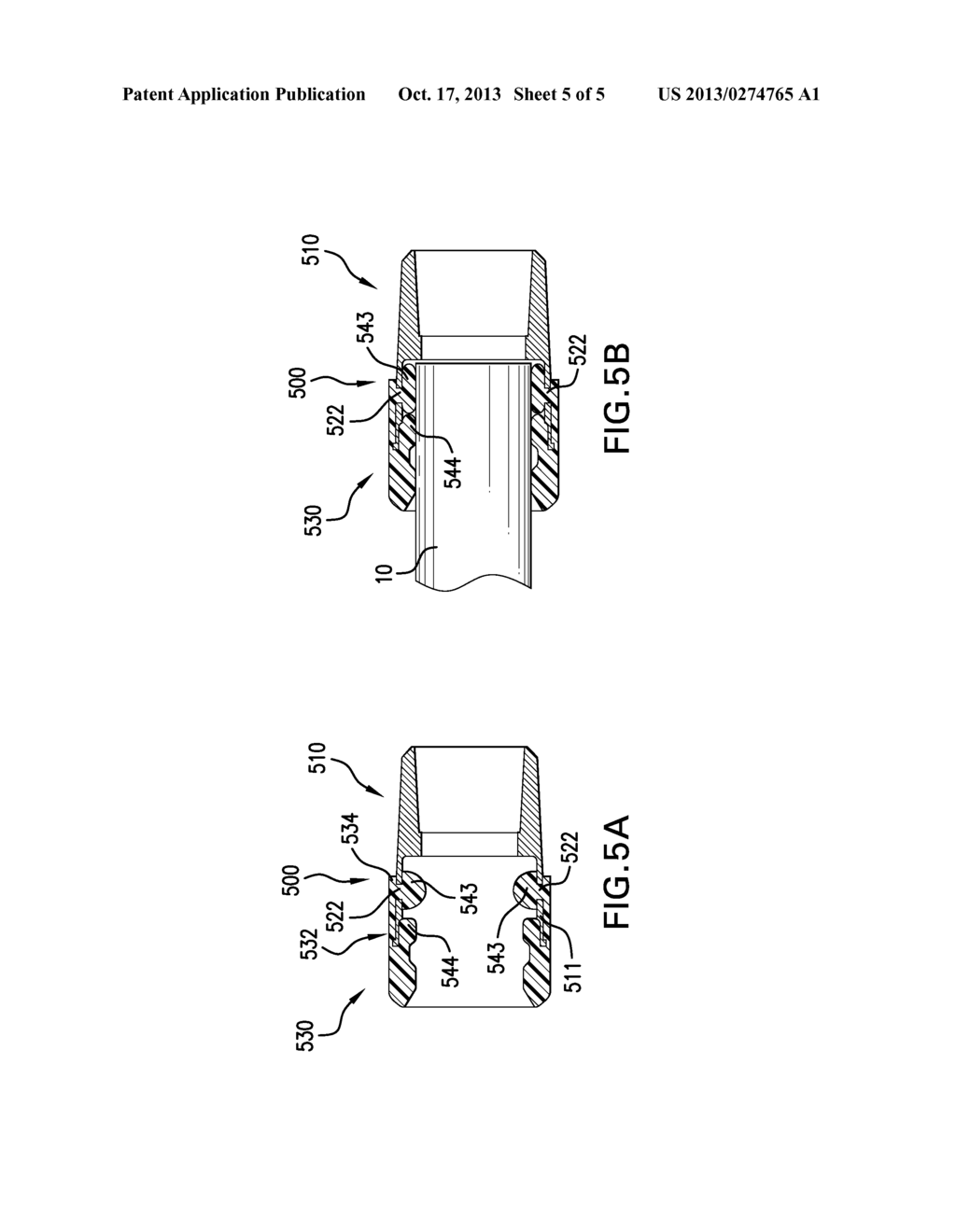 SECUREMENT STRUCTURE FOR JOINING MEDICAL DEVICE PARTS - diagram, schematic, and image 06