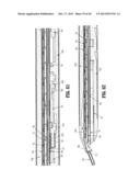 ENDOSCOPIC SURGICAL CLIP APPLIER diagram and image