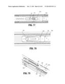 ENDOSCOPIC SURGICAL CLIP APPLIER diagram and image