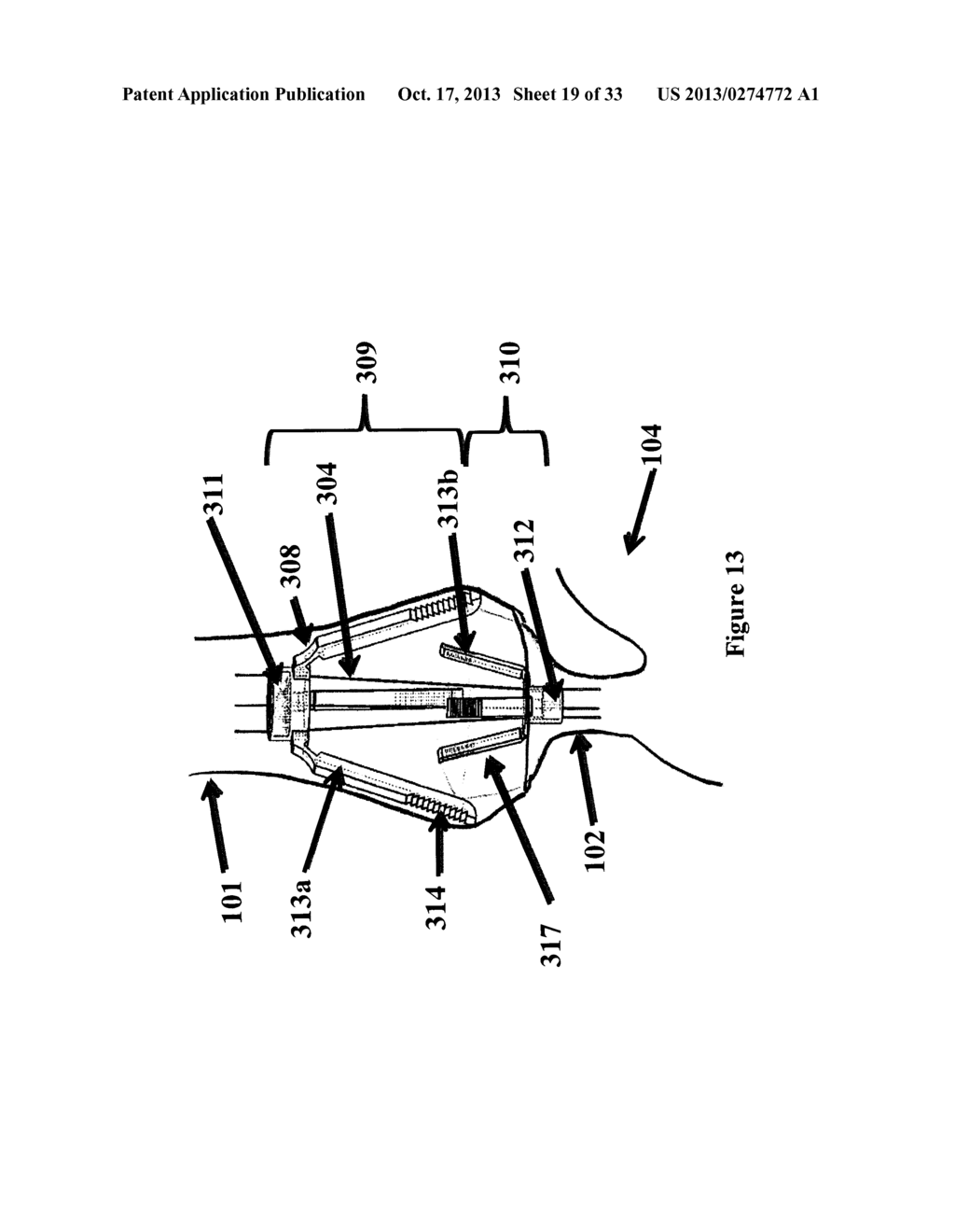 APPARATUSES AND METHODS FOR ANASTOMOSIS - diagram, schematic, and image 20