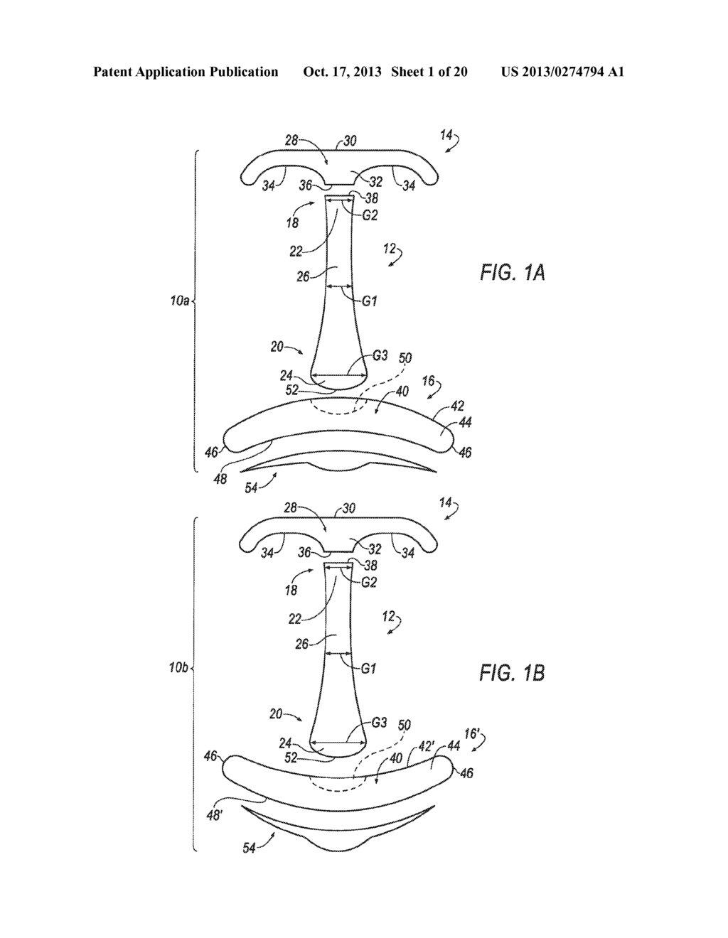 HEMOSTASIS DEVICE AND METHOD FOR USING THE SAME - diagram, schematic, and image 02