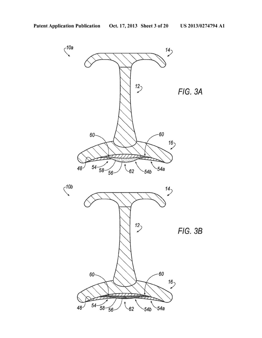 HEMOSTASIS DEVICE AND METHOD FOR USING THE SAME - diagram, schematic, and image 04