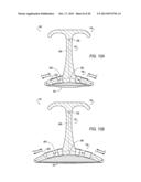 HEMOSTASIS DEVICE AND METHOD FOR USING THE SAME diagram and image