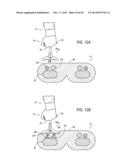 HEMOSTASIS DEVICE AND METHOD FOR USING THE SAME diagram and image